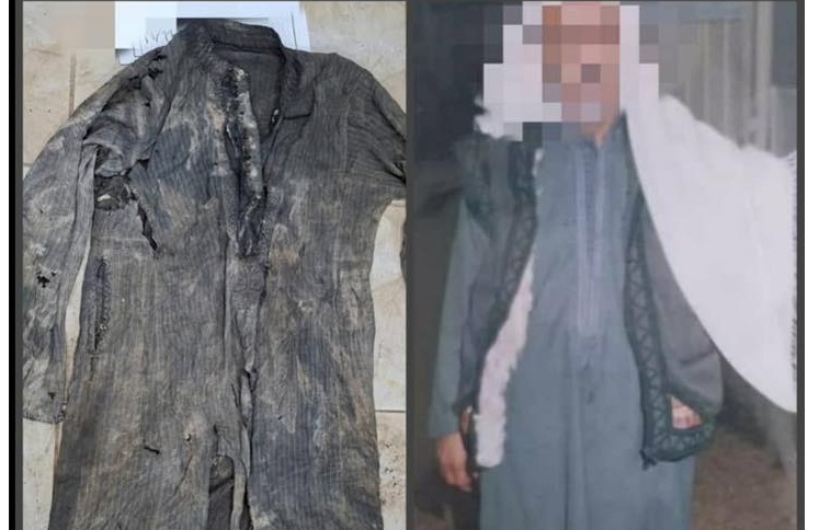 سوريا – ضلع مكسور يكشف هوية مفقود في حلب بعد 10 سنوات