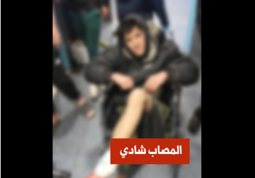 عصابات تشليح تطلق النار على شاب فوق جسر عقربا بريف دمشق