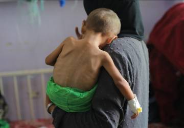 صحة غزة: ارتفاع وفيات التجويع الإسرائيلي إلى 271 بينهم 112 طفلا