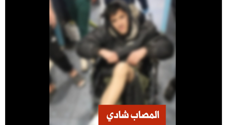 عصابات تشليح تطلق النار على شاب فوق جسر عقربا بريف دمشق