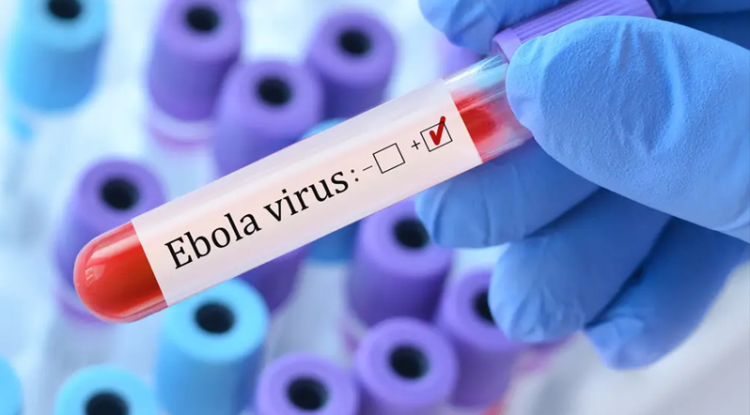 باحثون: فيروس إيبولا يظل على قيد الحياة في الدماغ لعدة أشهر