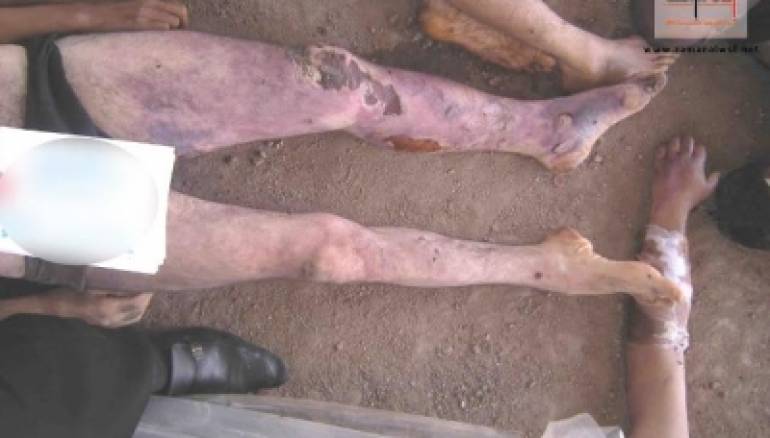 هكذا انتجت "معامل الموت" الأسدي 11 ألف شهيد بأرقام متسلسلة بينهم نساء 2