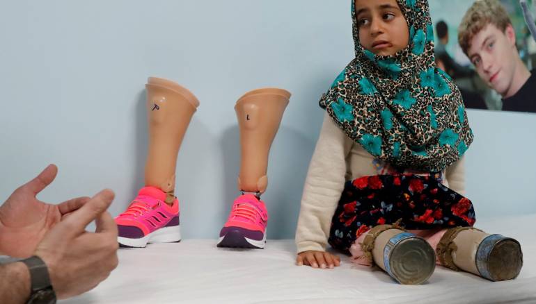 الطفلة السورية مايا مرعي تحصل على أطراف صناعية