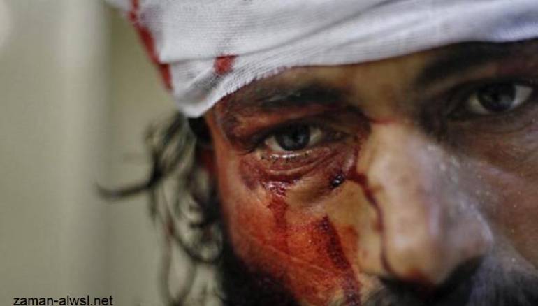 المســــــــــــــــــــــــيح السوري... عنصر مصاب من الجيش الحر في حلب