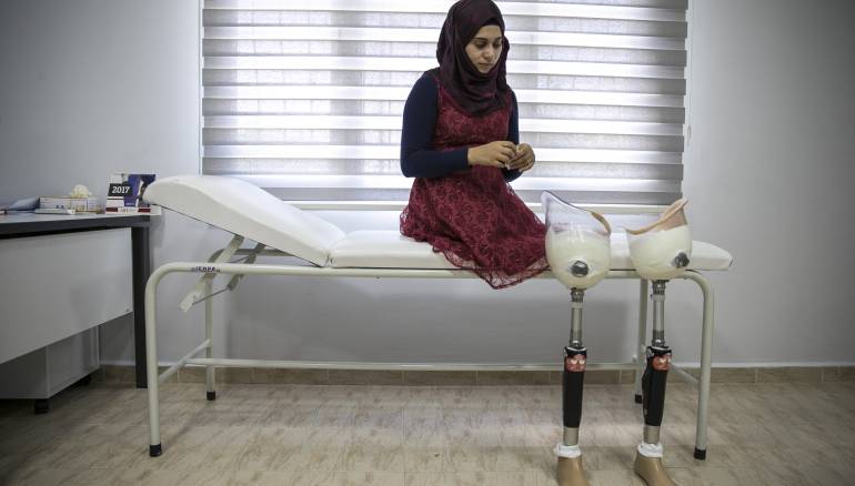 صور... فقدت قدميها لكن زوجها ساندها حتى النهاية
